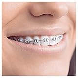 Oral-B Teen Elektrische Zahnbürste, für Teenager ab 12 Jahren, mit visueller Andruckkontrolle, schwarz - 8