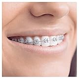 Oral-B Teen Elektrische Zahnbürste, für Teenager ab 12 Jahren, mit visueller Andruckkontrolle, weiß - 8